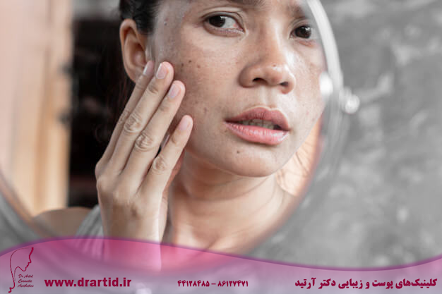 asian woman checking face with dark spot mirror 34670 806 - انواع پوست و چگونگی تشخیص هریک از انواع آن