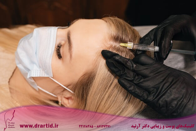 beautician gloves gives injection into head blonde woman mesotherapy hair loss therapy hair restoration concept 251474 605 - فیلر مو انقلابی جهت تقویت مو و بهبود ریزش آن