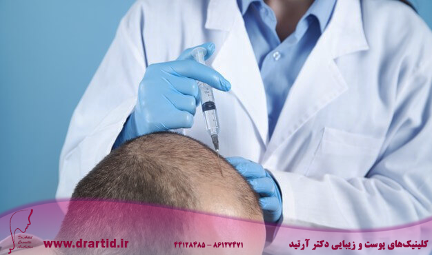 doctor makes injection man head hair growth 220873 3433 - فیلر مو انقلابی جهت تقویت مو و بهبود ریزش آن