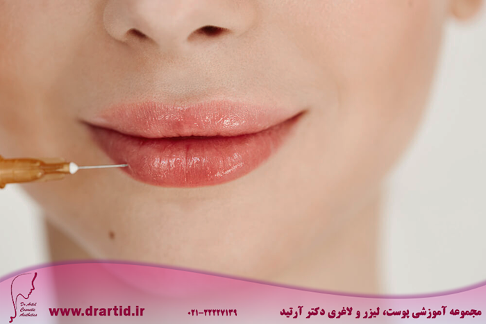 close up medical botox injection lips facial treatment - چگونه به یک متخصص تزریق ژل لب تبدیل شویم؟