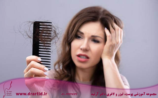 Hair Loss 1024x400 - درمان ریزش مو بعد از کرونا