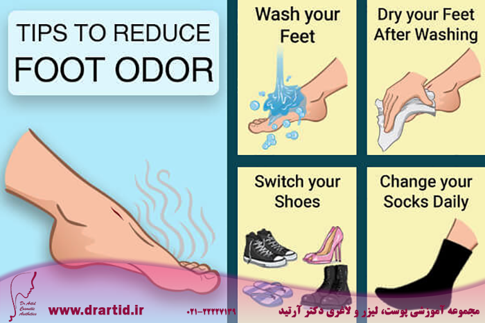 foot odor - چگونه از شر بوی بد پاها خلاص شویم؟!